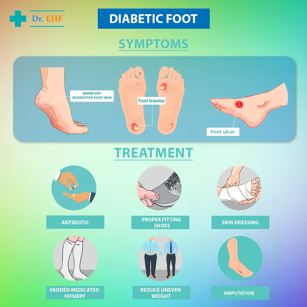 Diabetic Foot Ulcers Venous Or Arterial Ulcers: Posters, 42% OFF